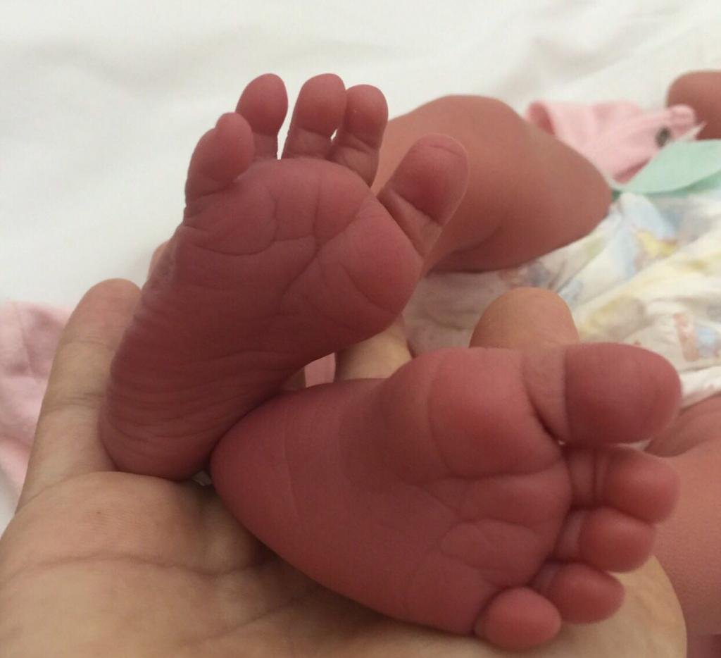Пяточки новорожденного