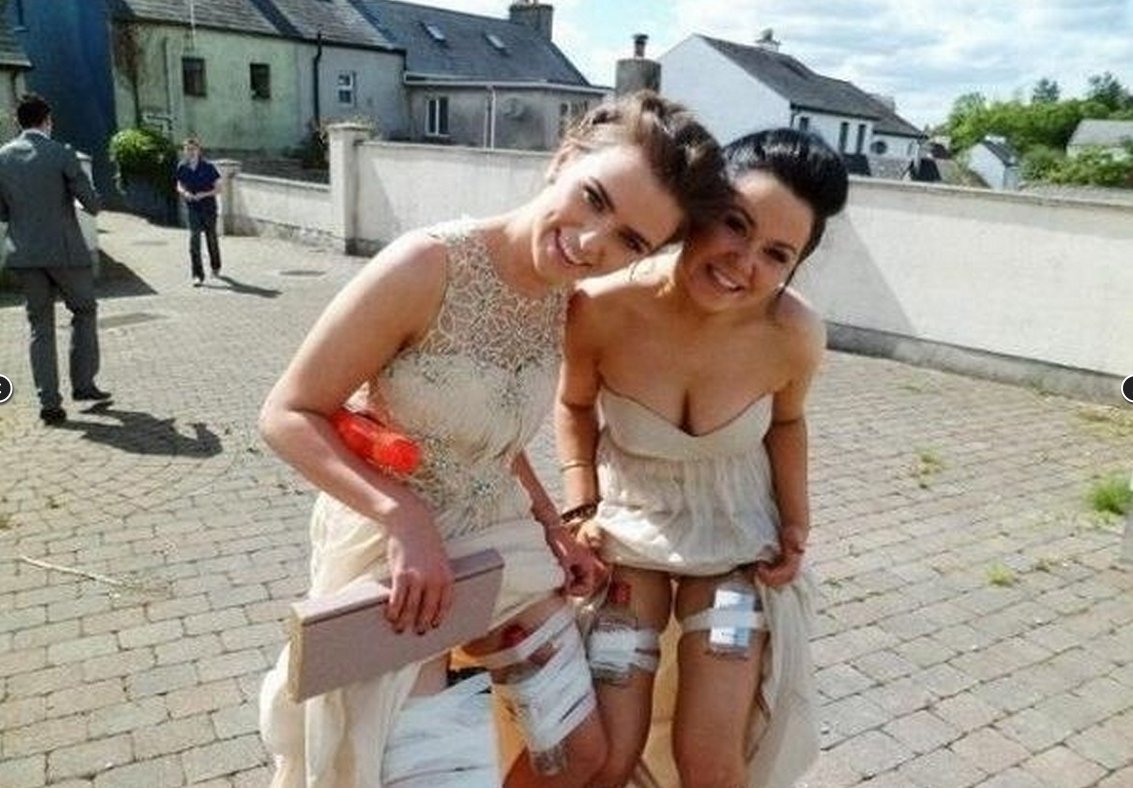 Дурочка юмор