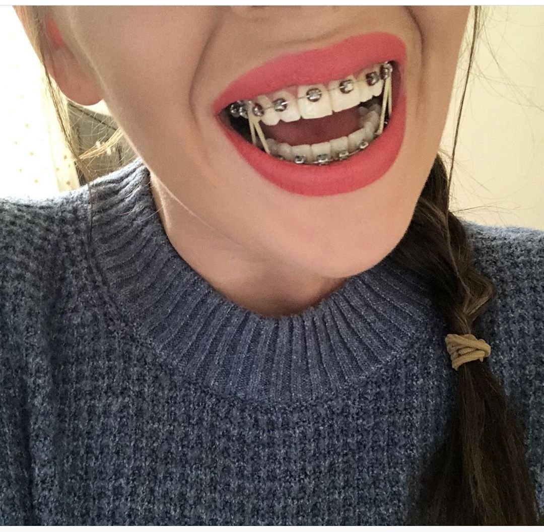 Зуб в графике