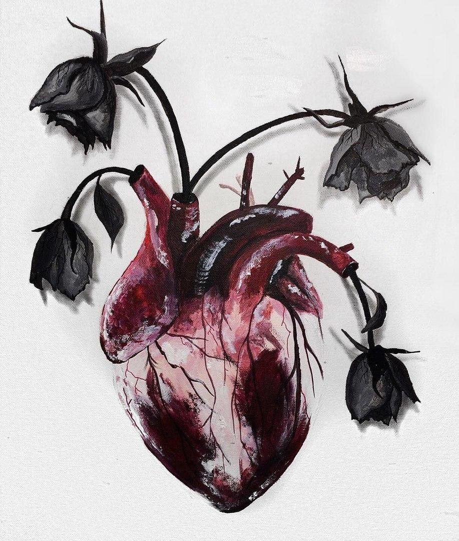 Пластырь на разбитом сердце