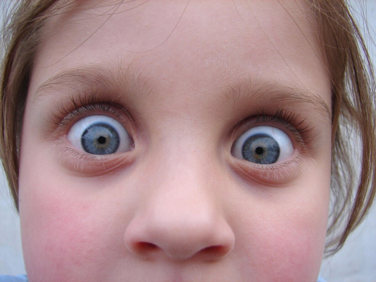 Удивленные глаза