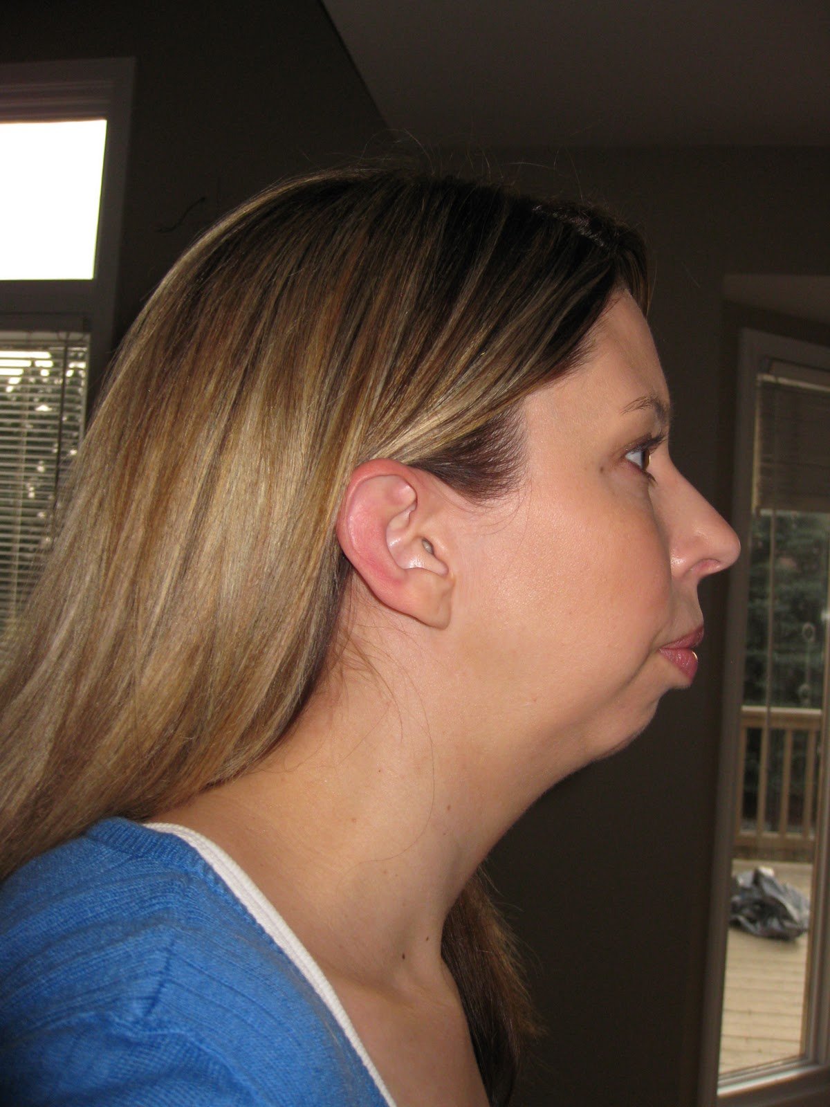 Некрасивый профиль лица