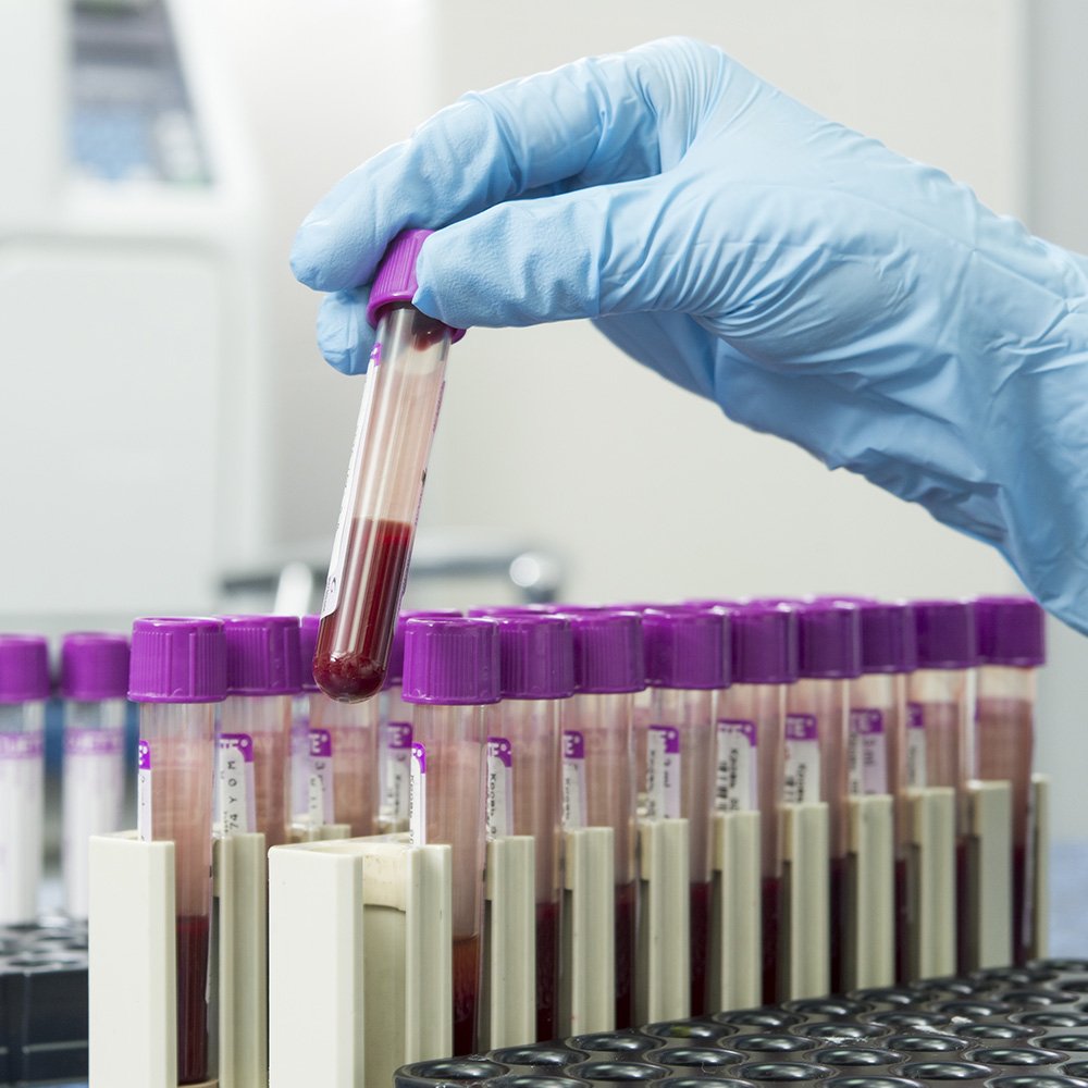 Лаборатория пробирки