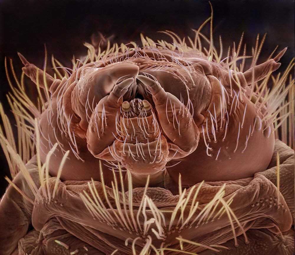 Мерзкие насекомые под микроскопом