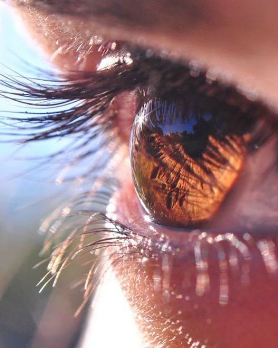 Цветные линзы гетерохромия