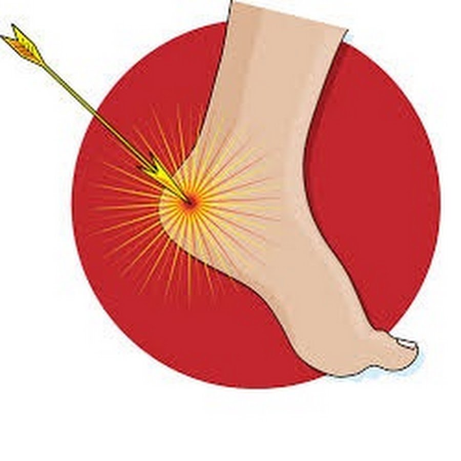 Крылатое выражение ахиллесова пята