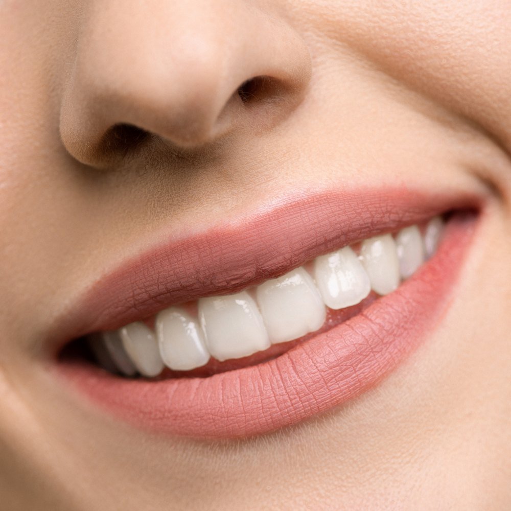 Красивые зубы