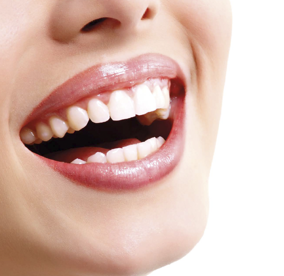 Правильная улыбка