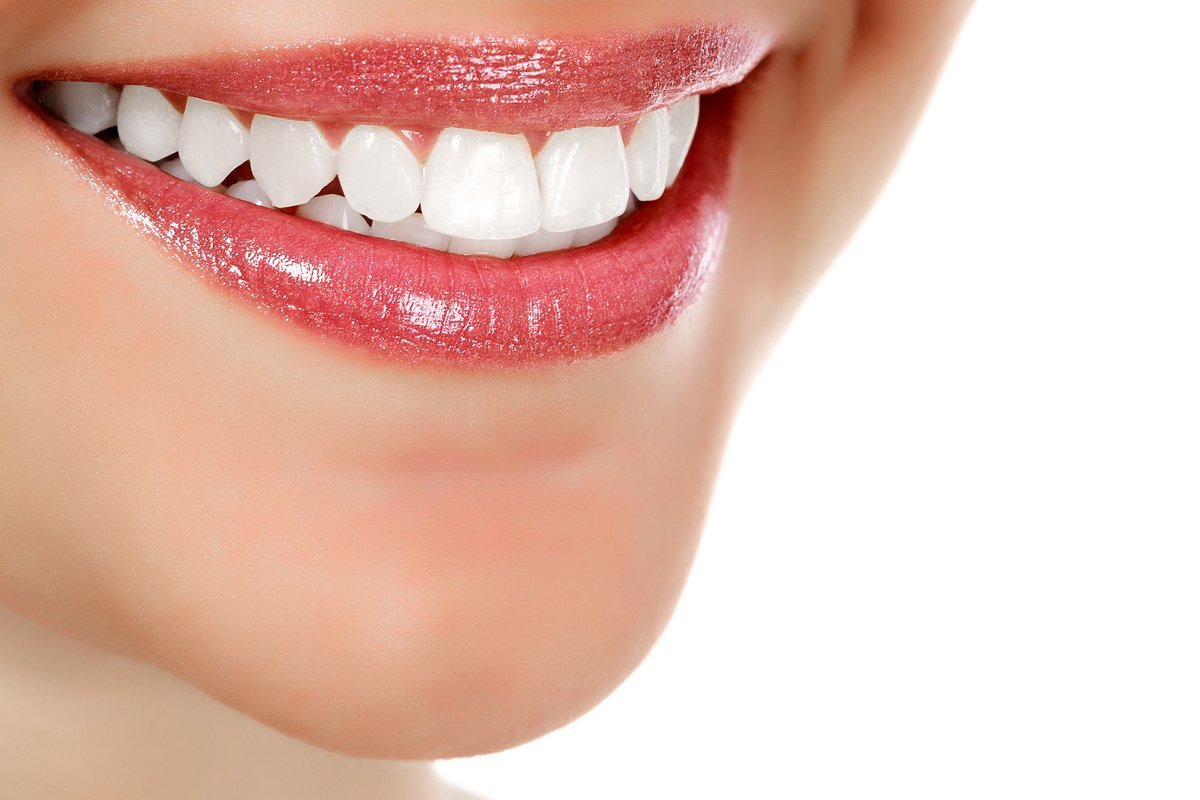 Красивая улыбка