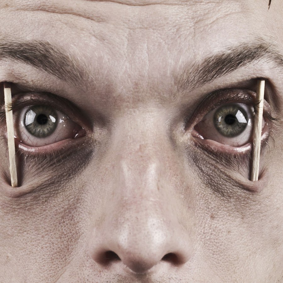 Спички в глазах