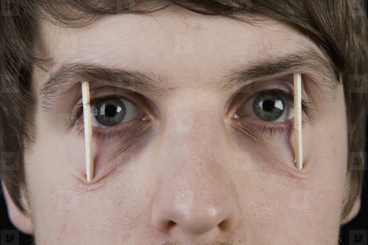 Спички в глазах