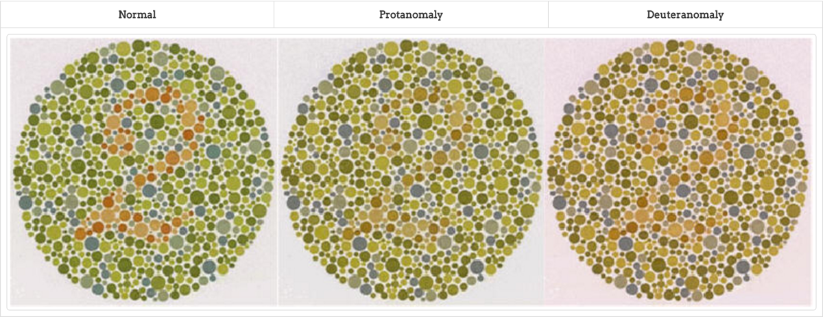 Врожденный дальтонизм