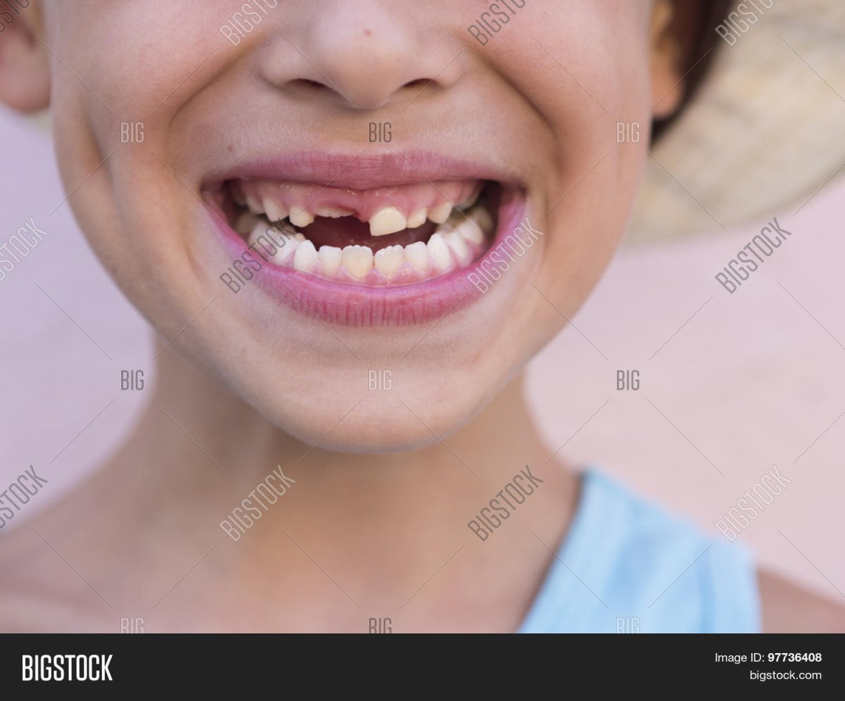 Зубы ребенка мультяшные