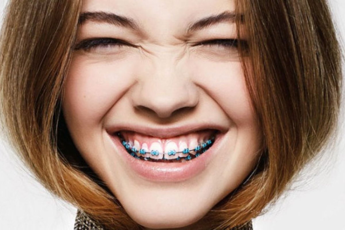 Маленькие девочки без зубов