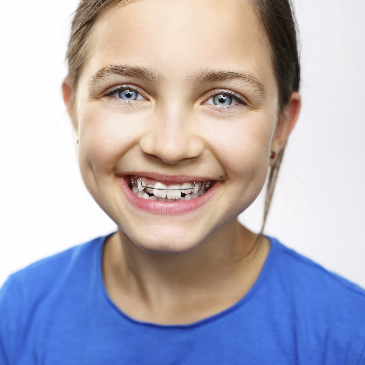 Даша Щербакова брекеты