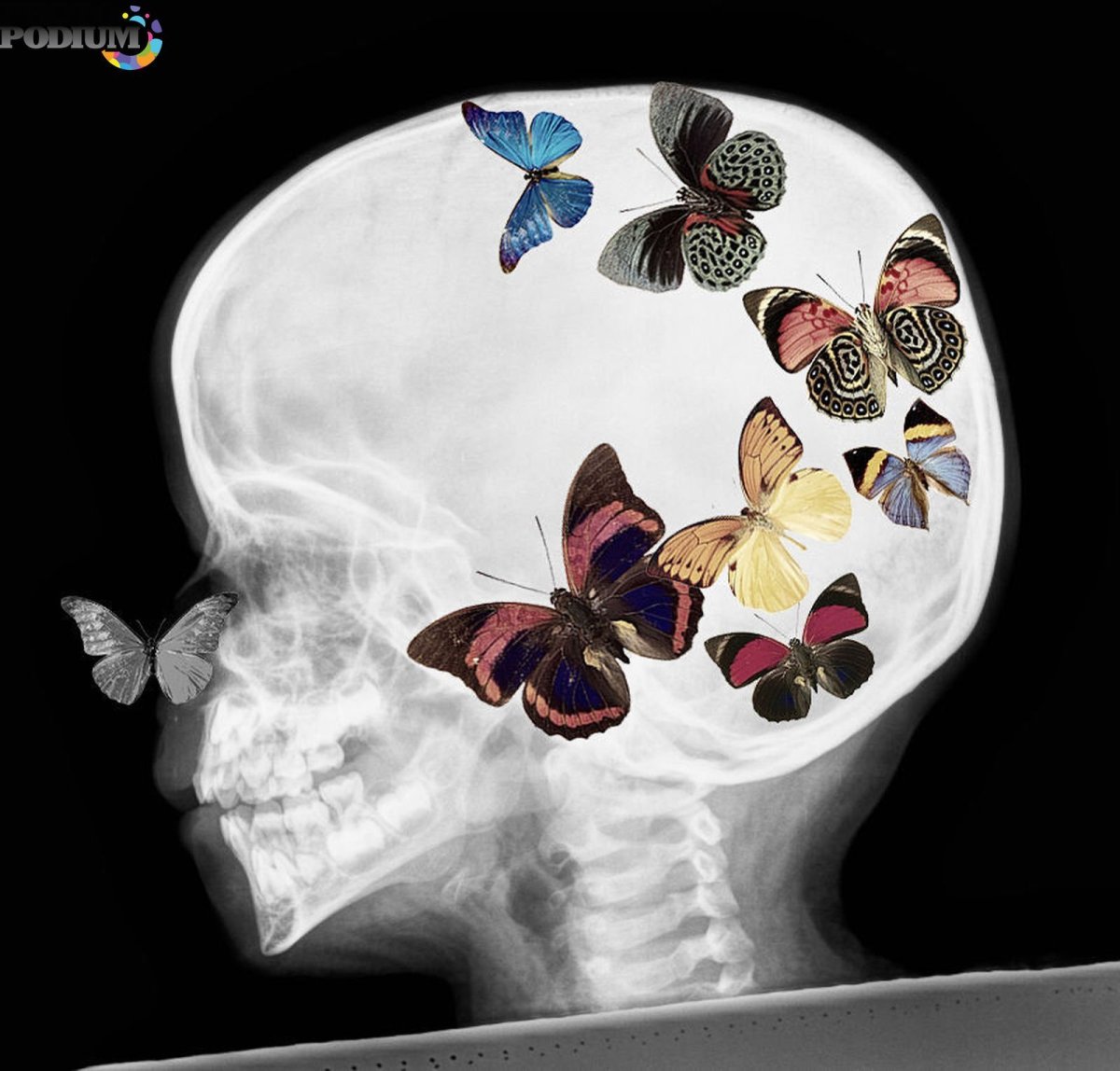 Бабочки в животе рентген