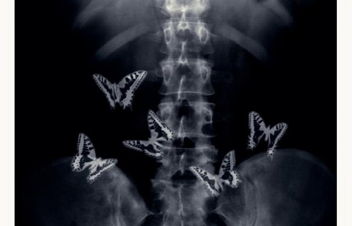 Стикеры анатомия