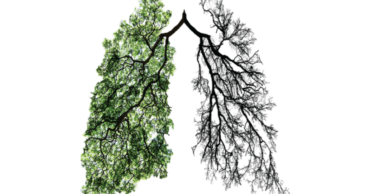 Защита окружающей среды