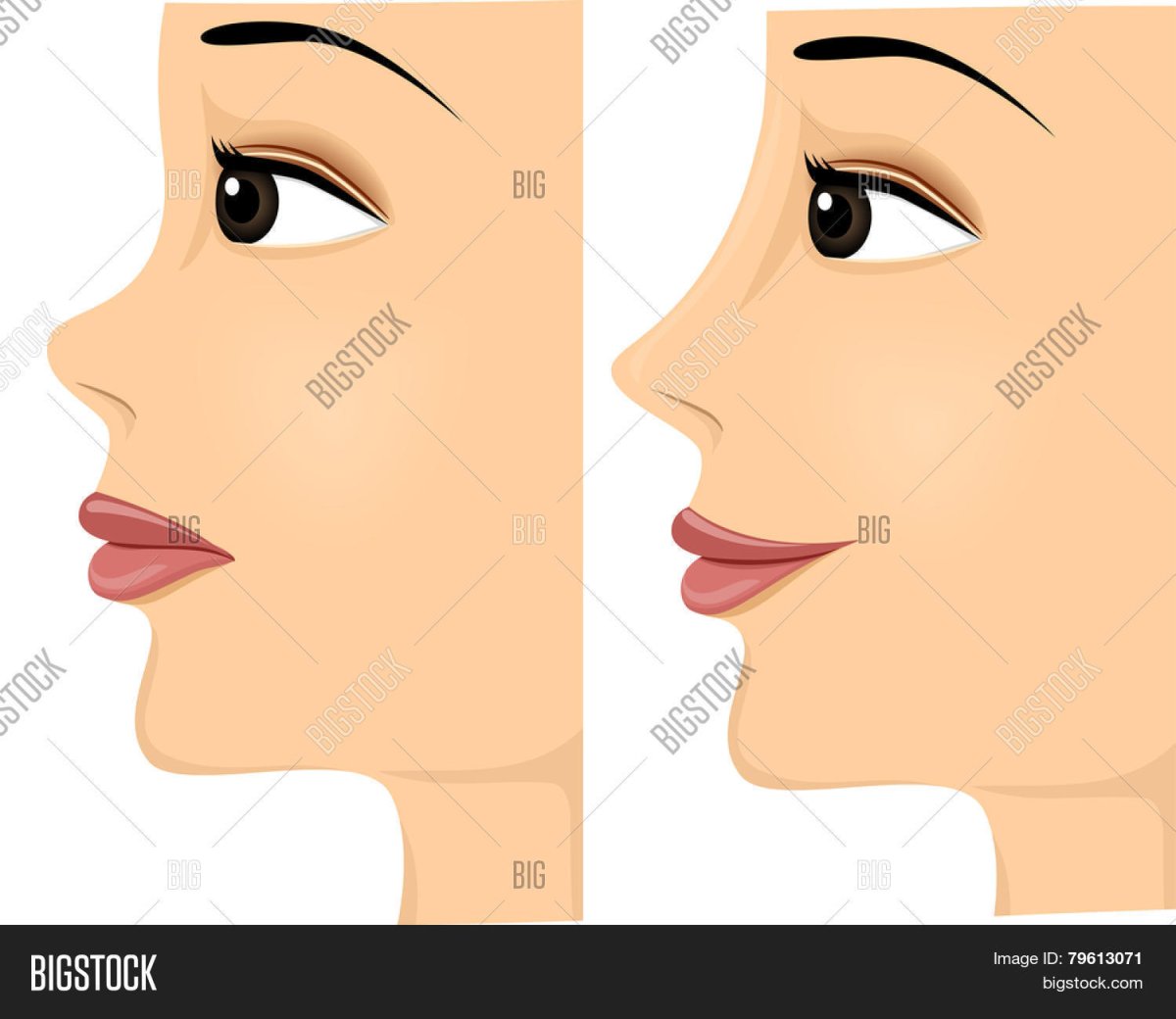 Кот с Божьей коровкой на носу