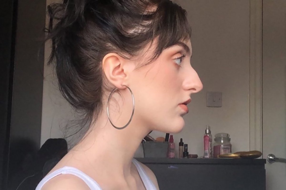 Энн Хэтэуэй нос с горбинкой