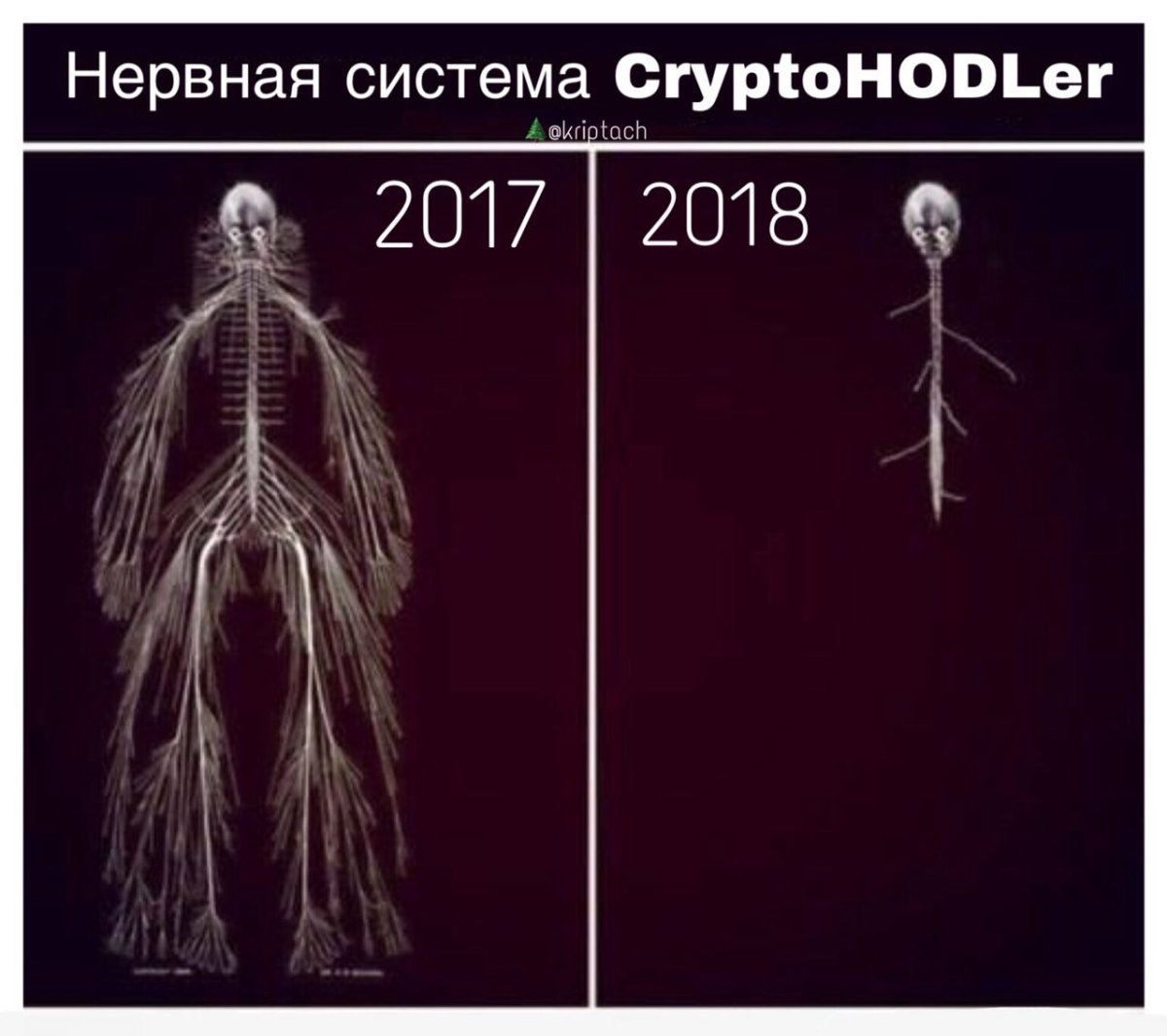 Нервная система прикол