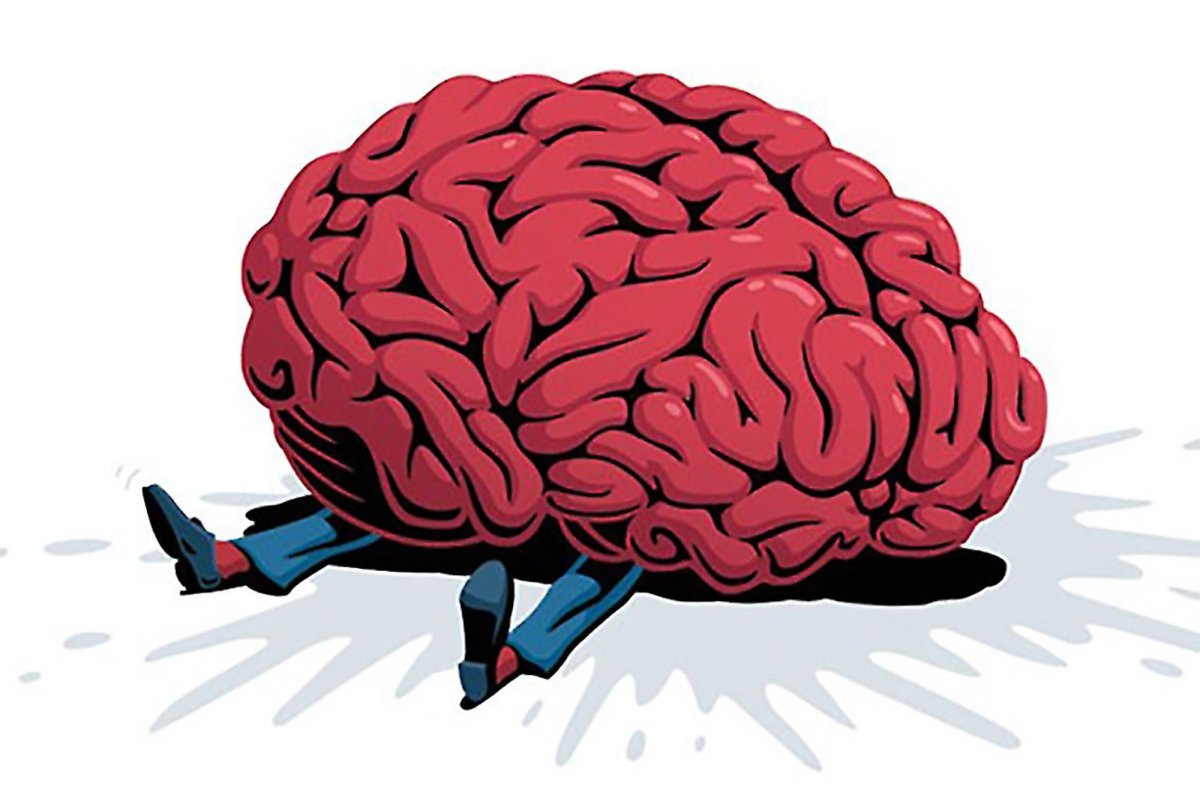 Мозг арты