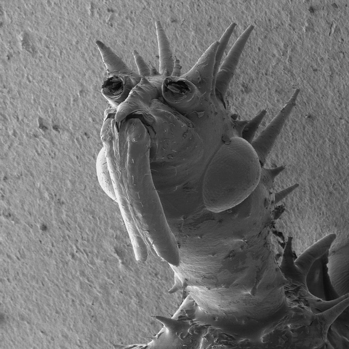 Бактерии под микроскопом