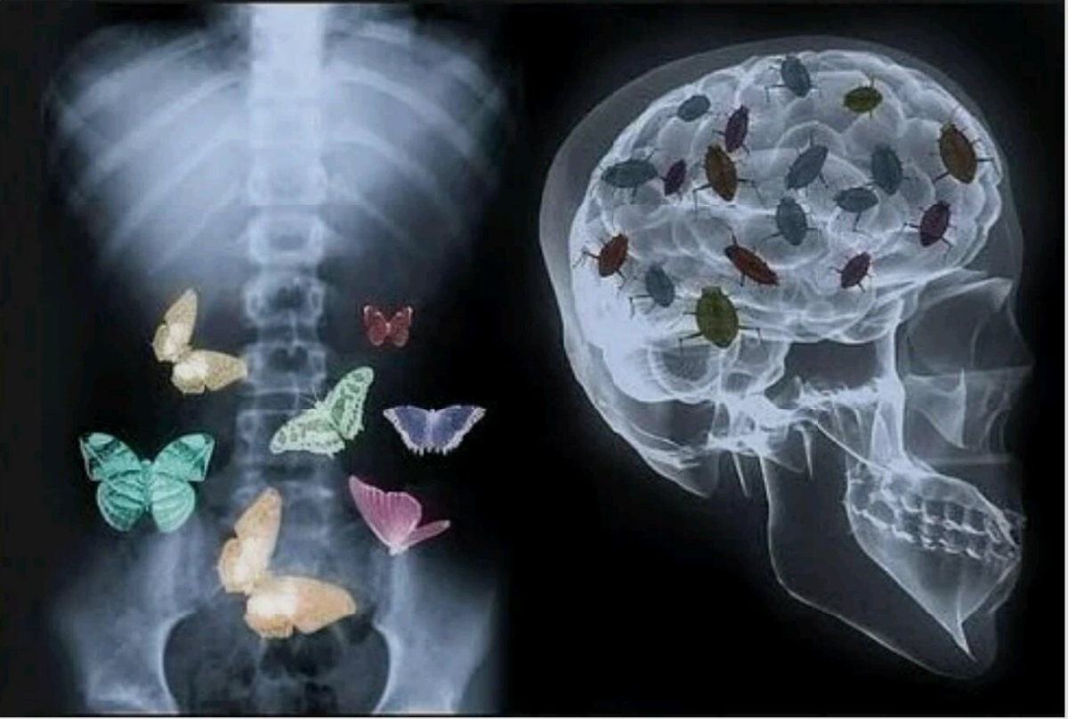 Тараканы в голове