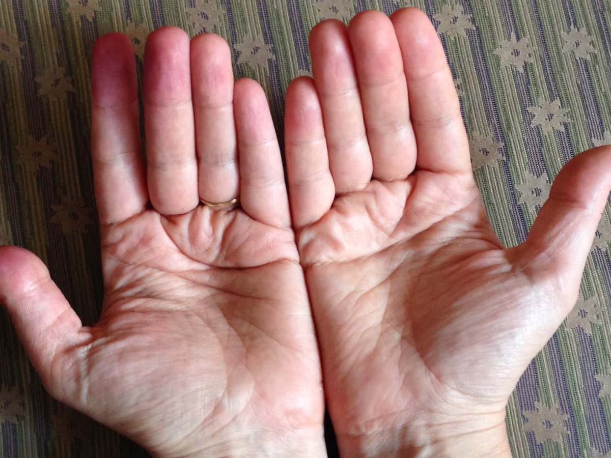 Хиромантия Обезьянья линия