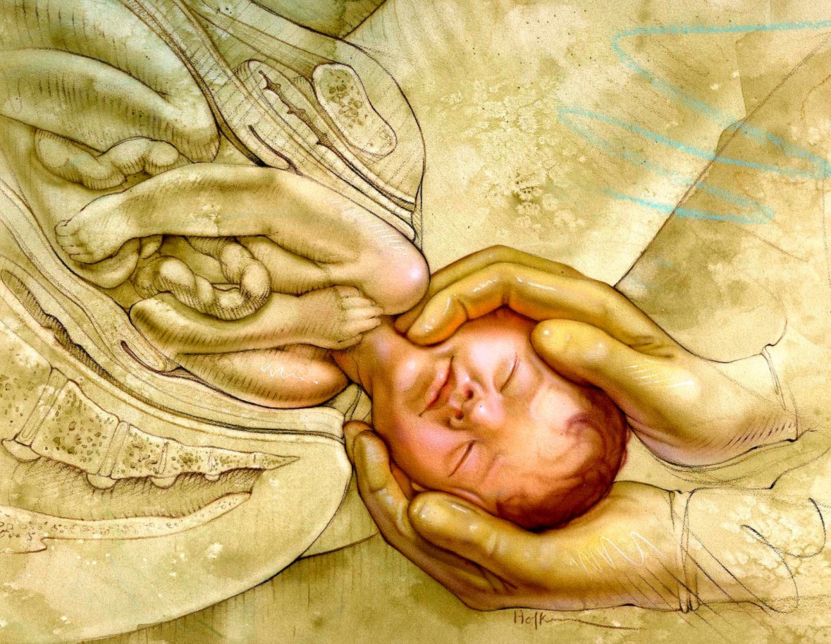 Акушерство рисунки