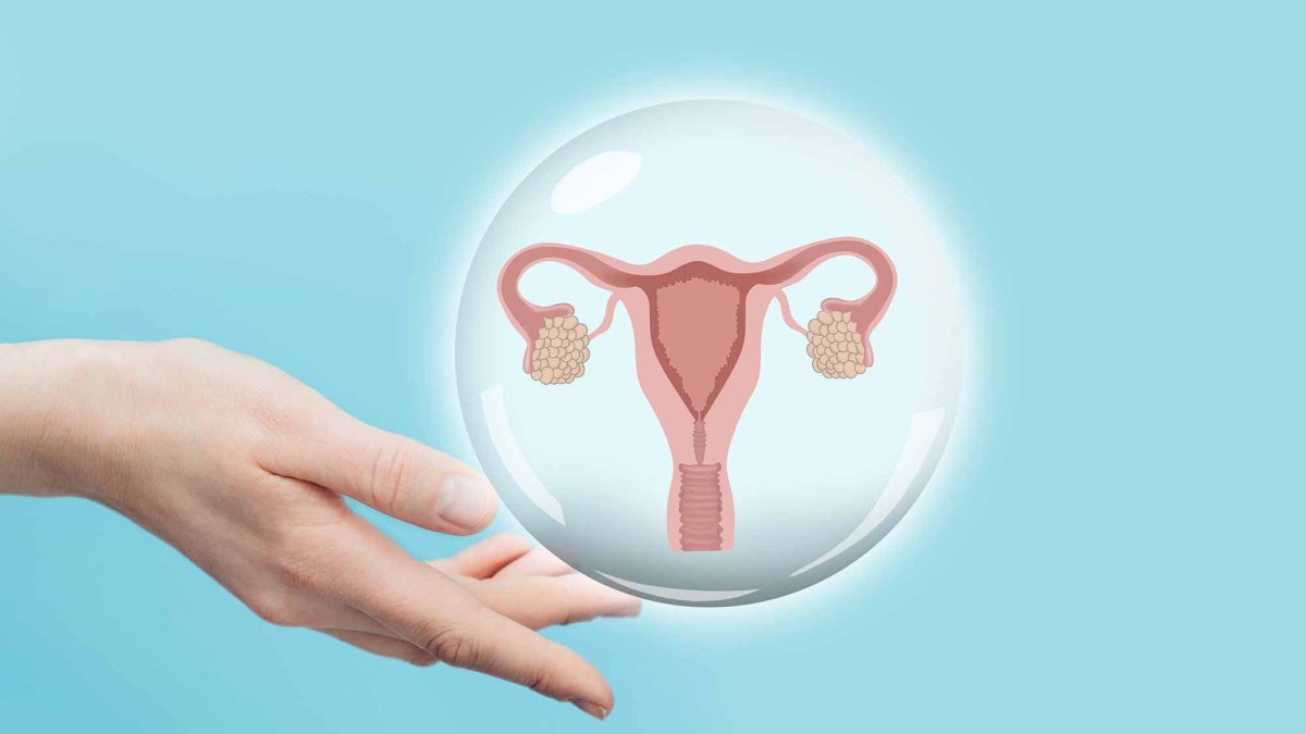 Кольцо гормональное противозачаточное