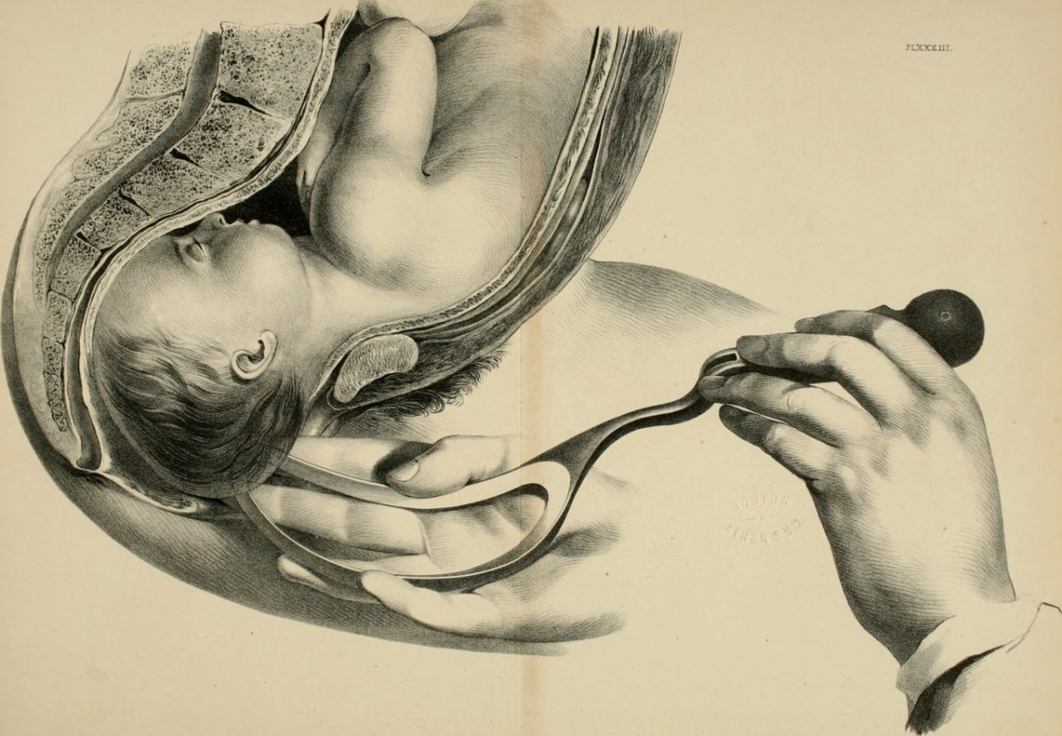 Матка в цветах