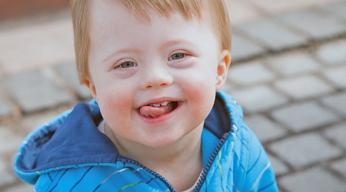 Яркие фото особенных детей