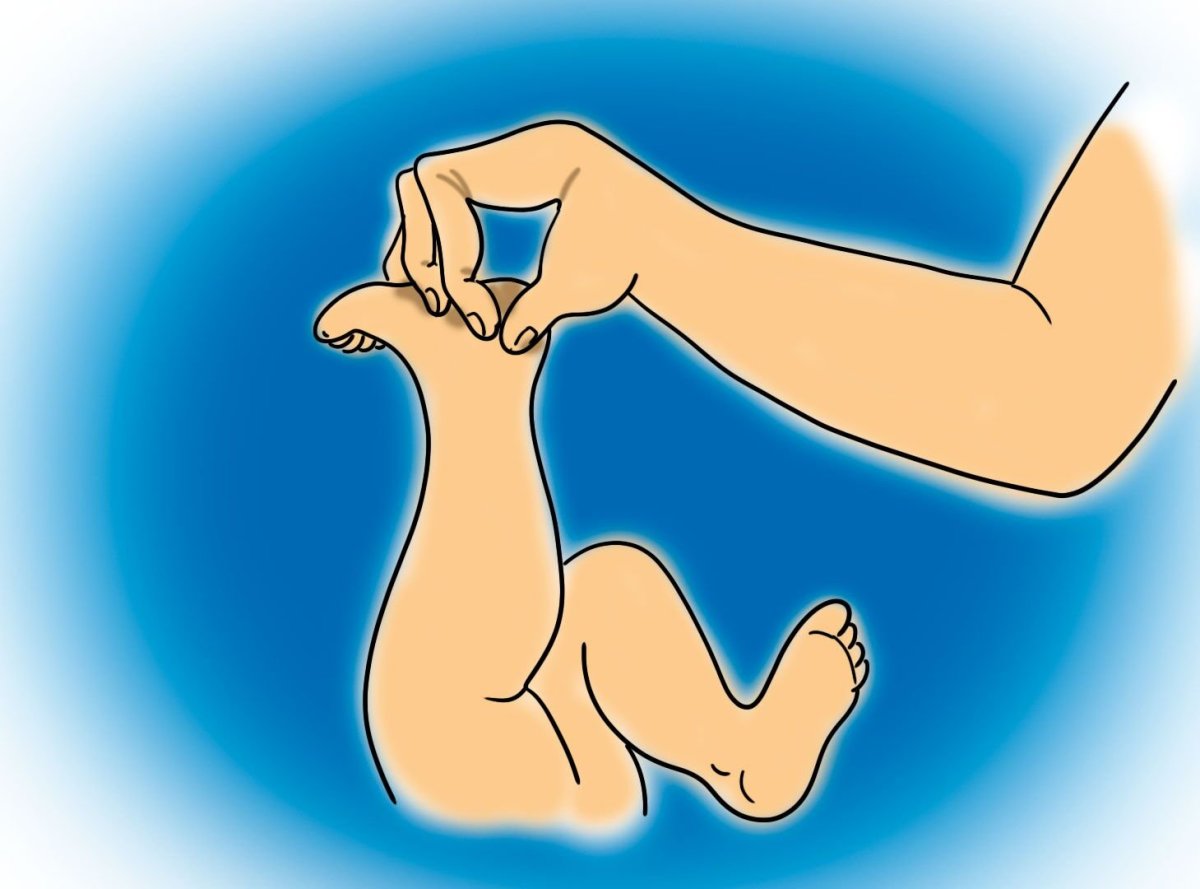 Ахиллесова пята фото