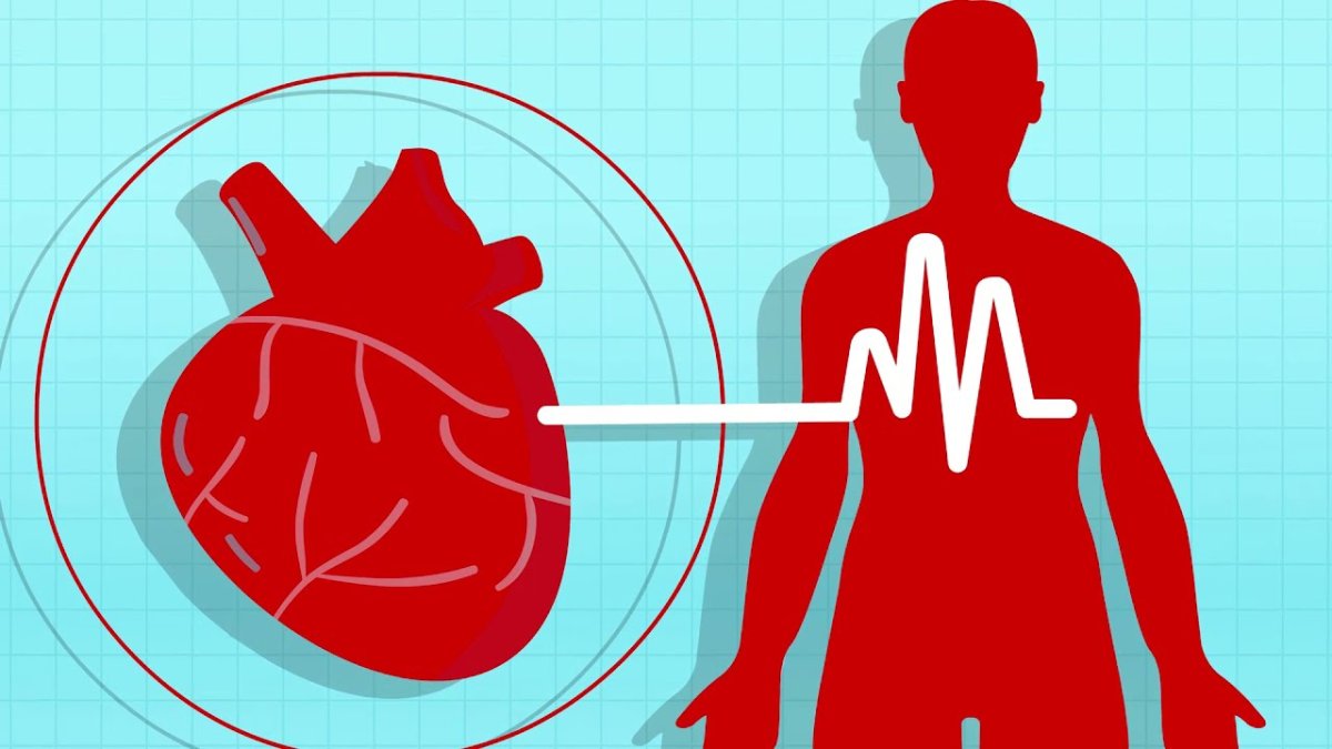 Артериальная гипертония вектор