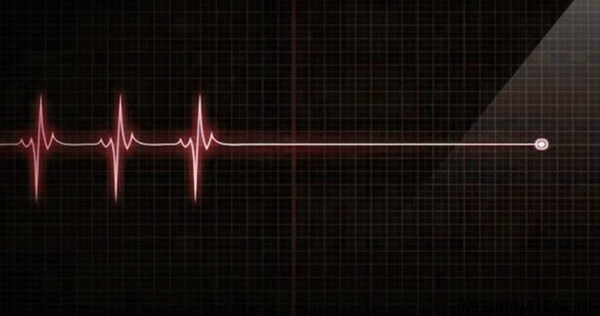 Кардиограмма смерти