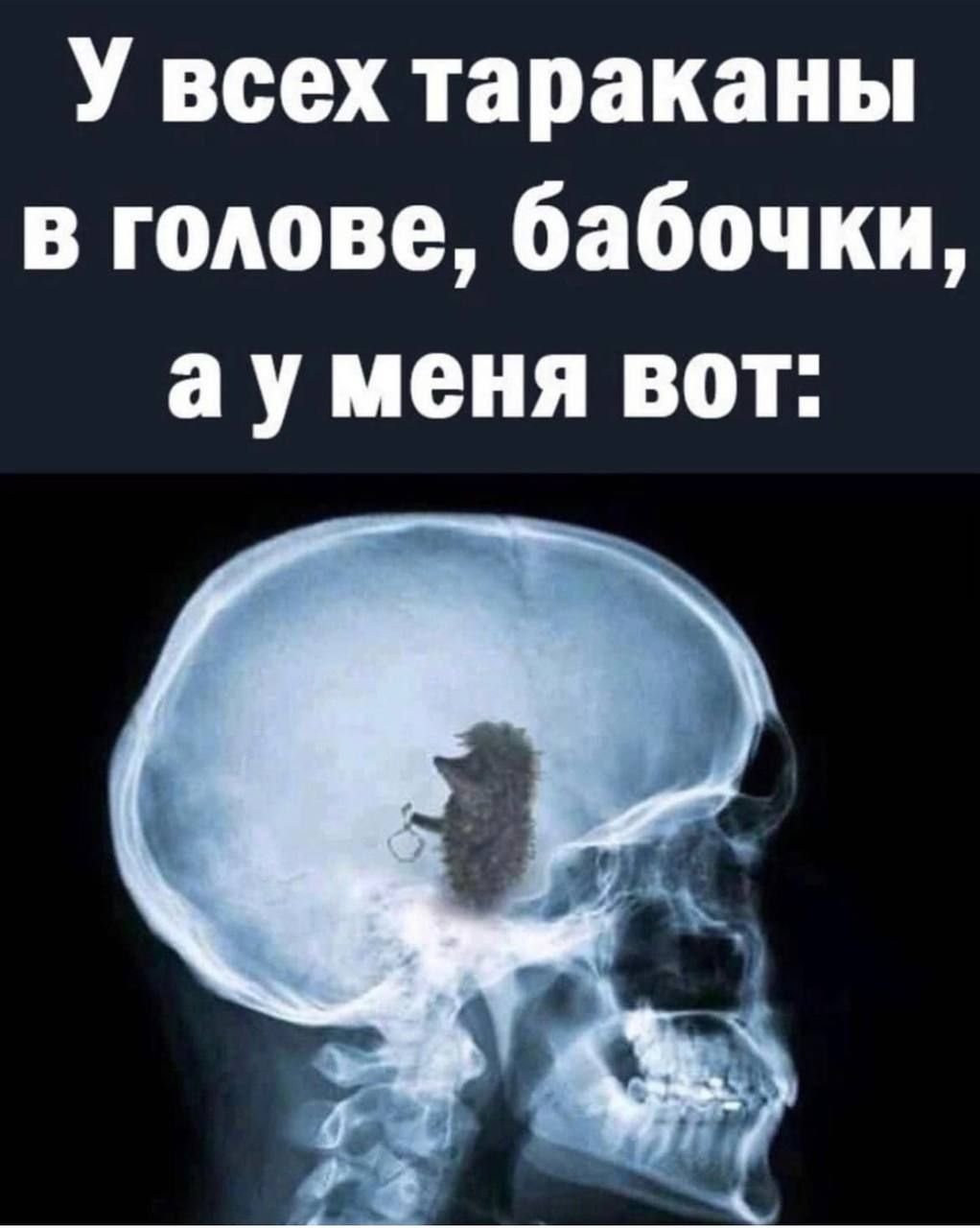 Че сразу жру то картинки