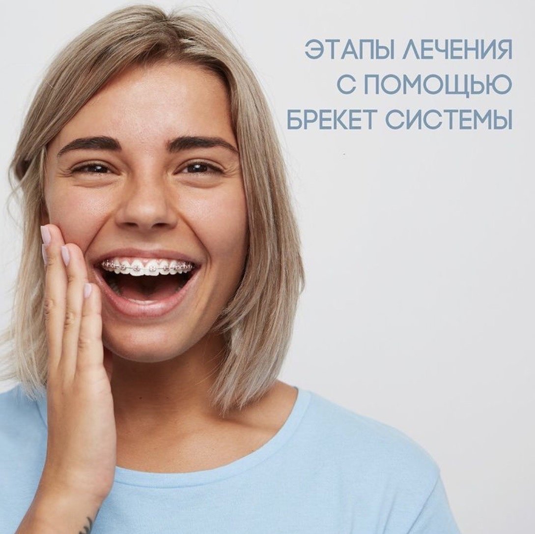 Меди Лайт Рязань