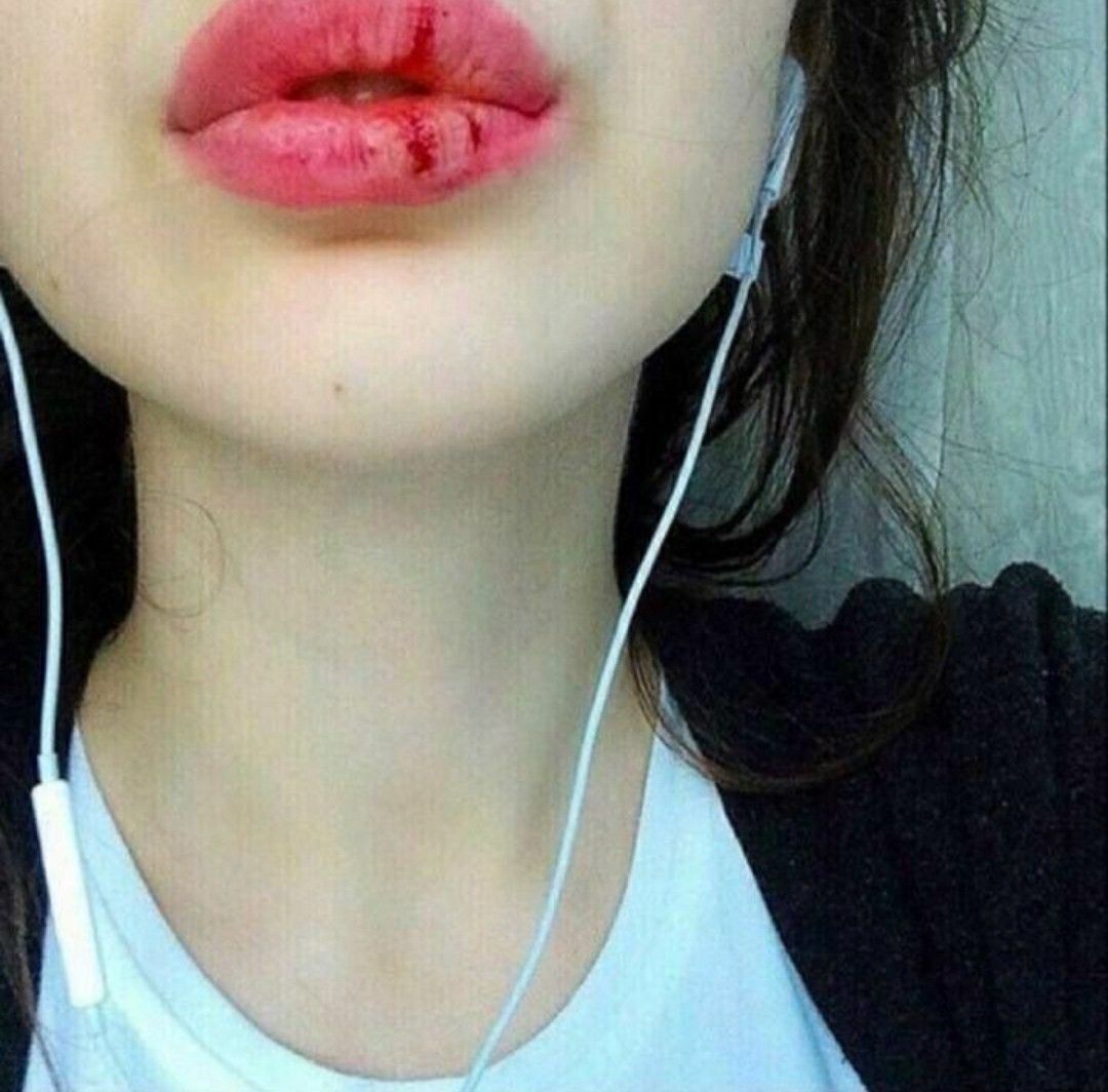 Русские с накаченными губами