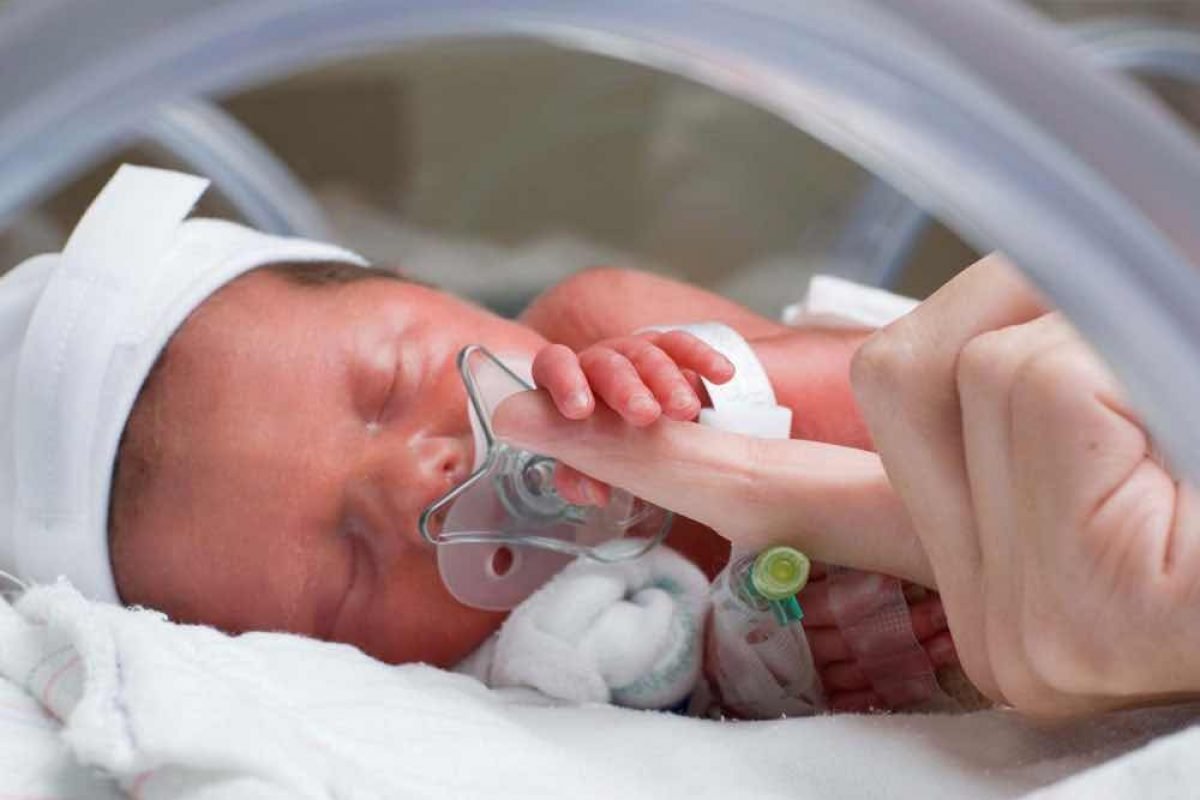 Недоношенных новорожденных