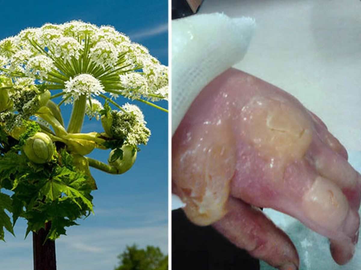 Борщевик Сосновского