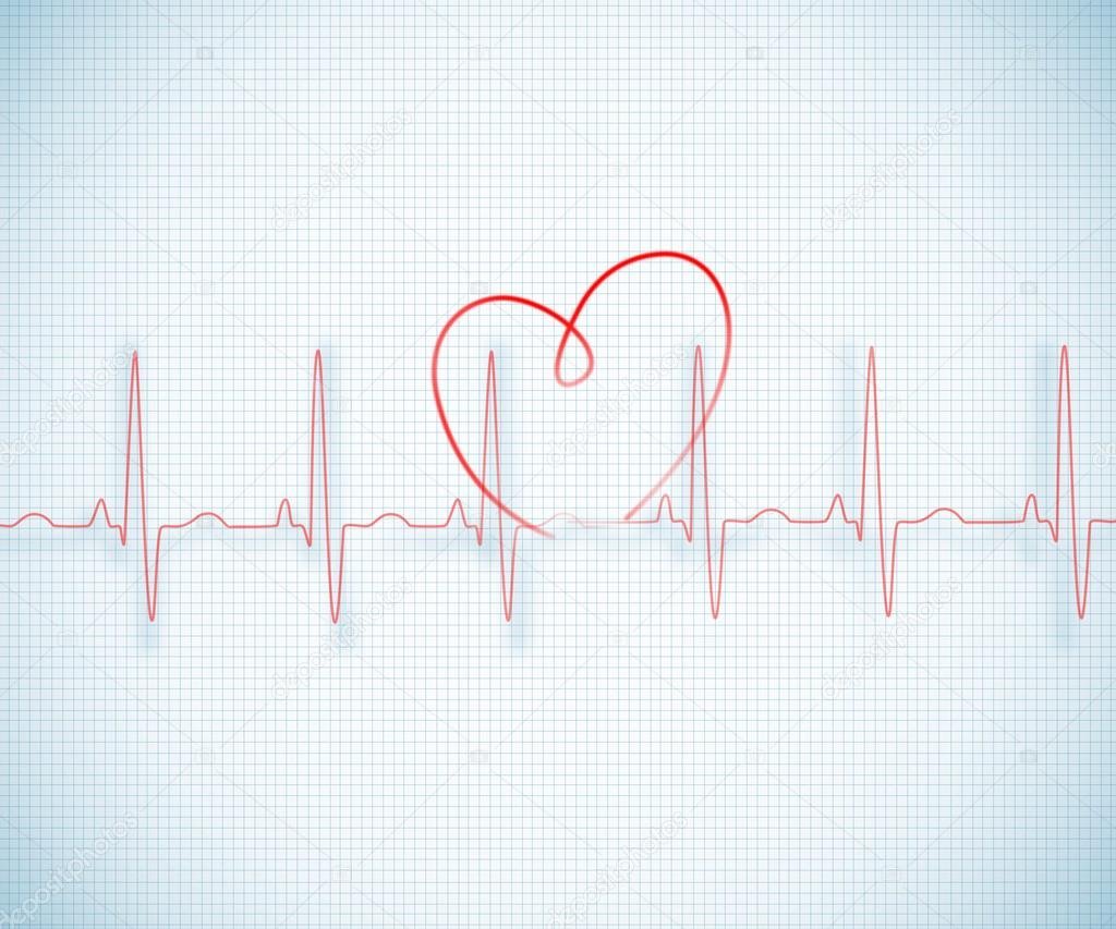 ЭКГ фон