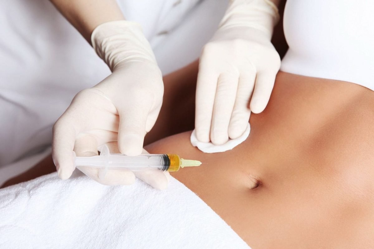 Липолитическая мезотерапия