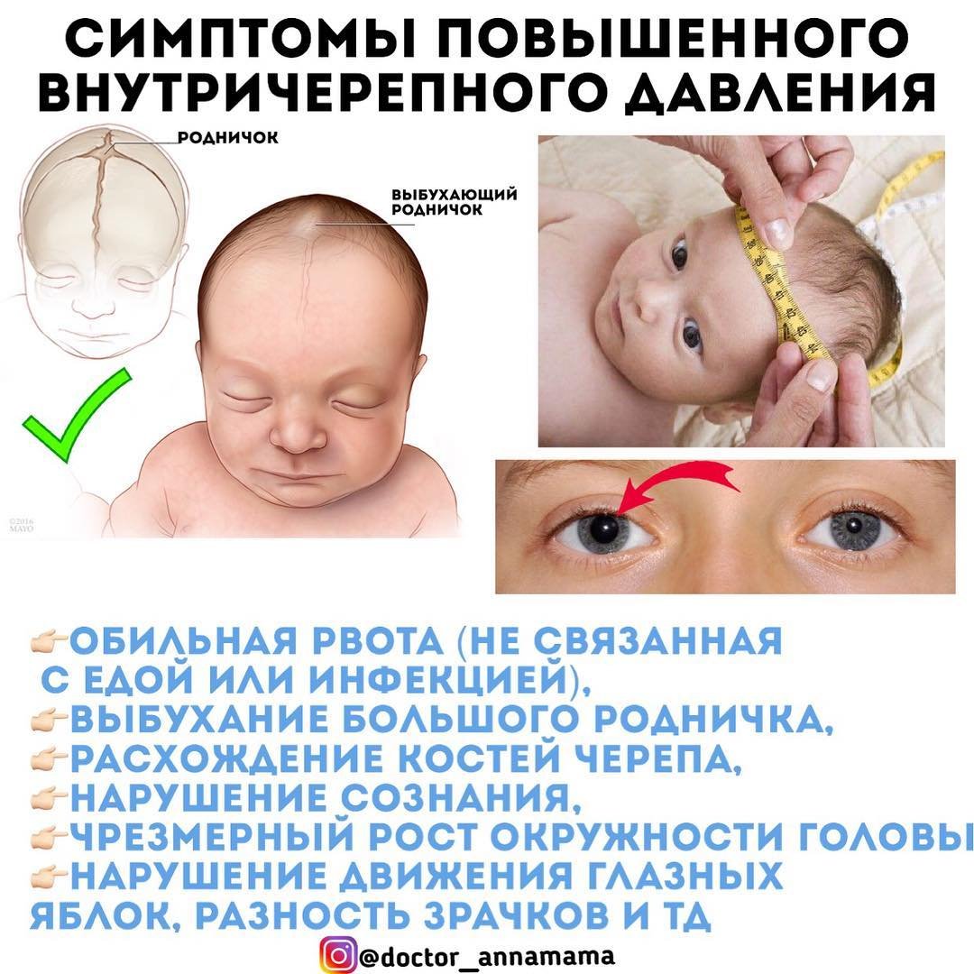 Наружный тромбированный геморрой