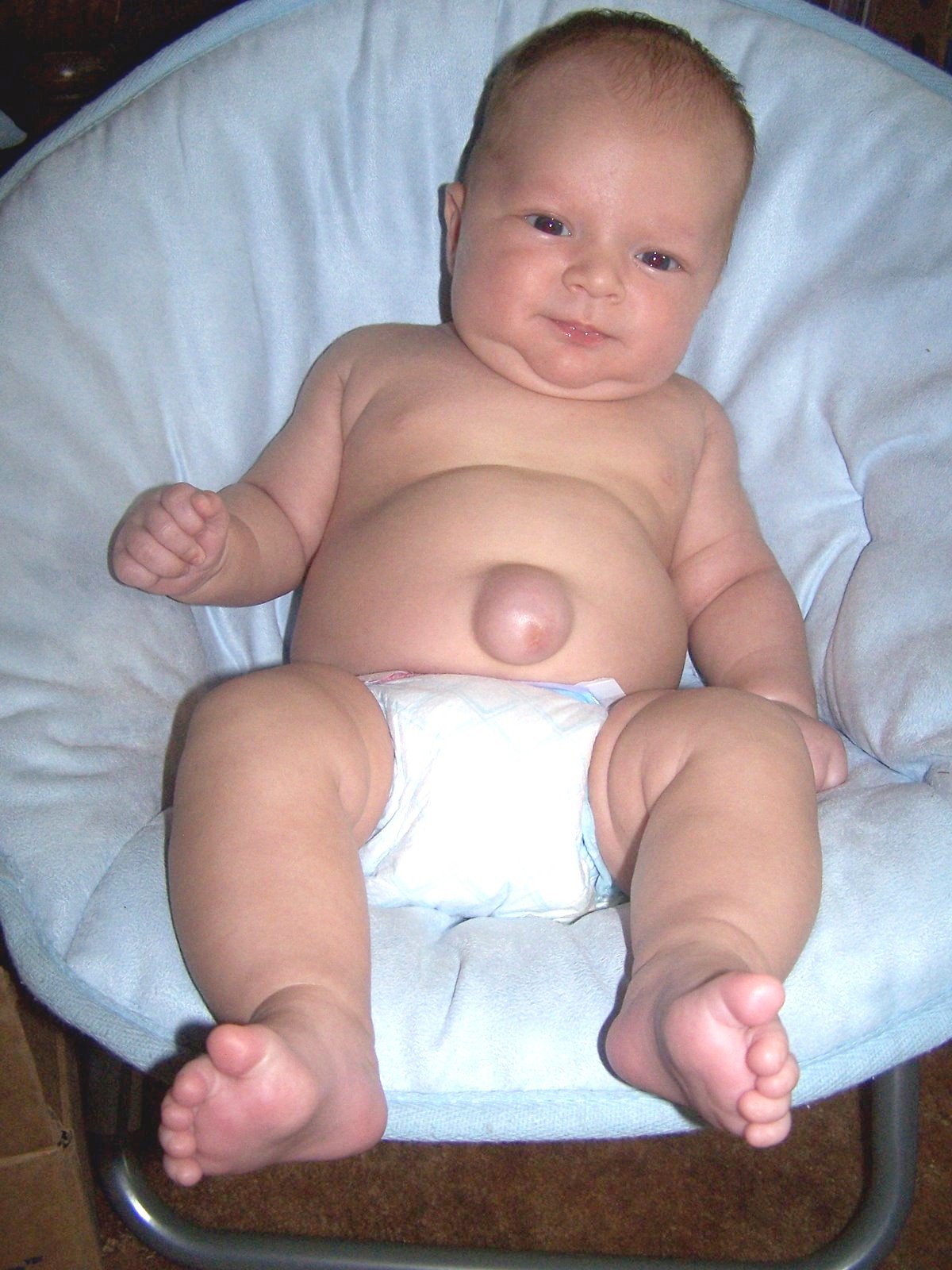 Половые органы новорожденных