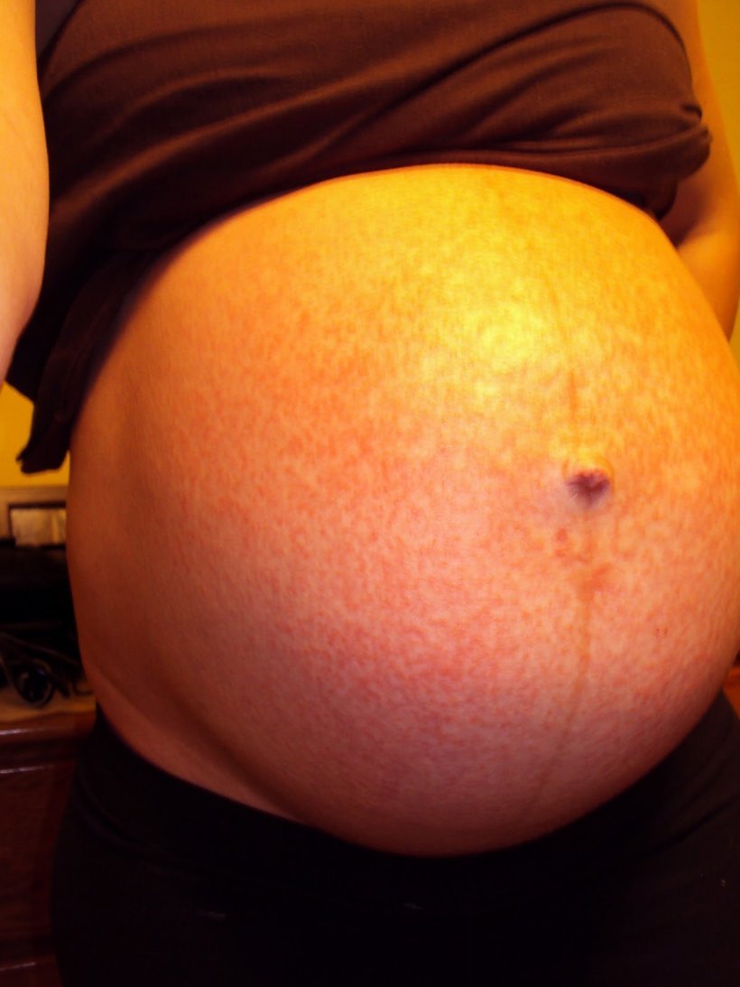 Шикша- водяника, вороника