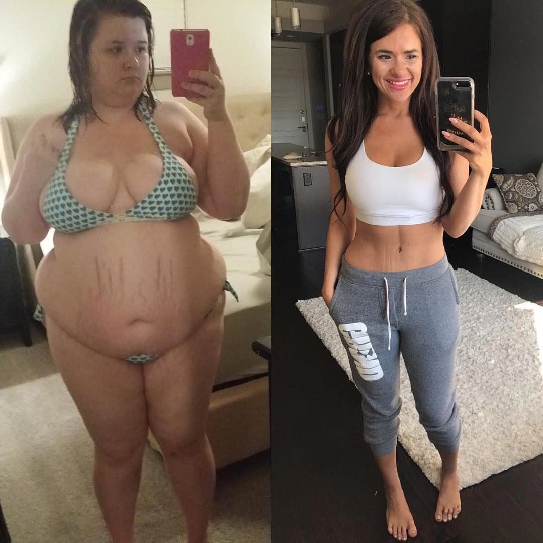 Экстремальное похудение до и после