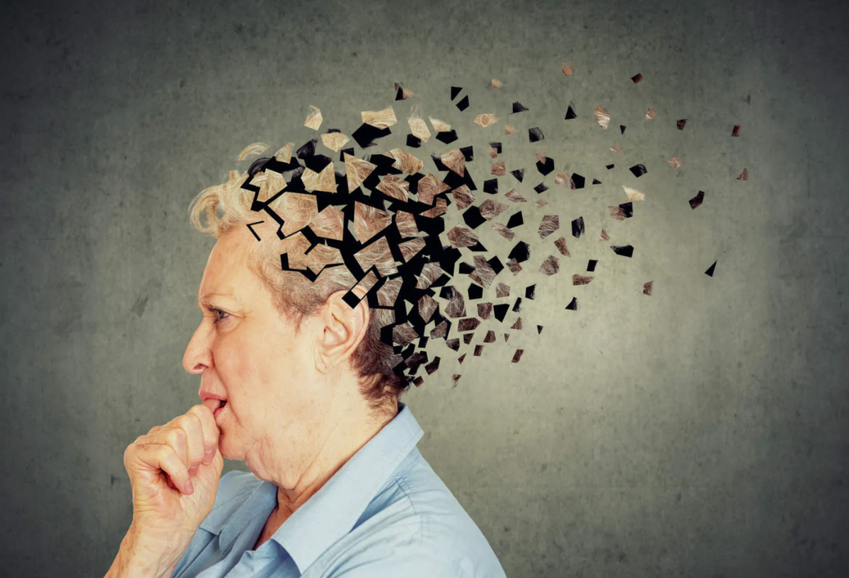 Люди с Альцгеймером