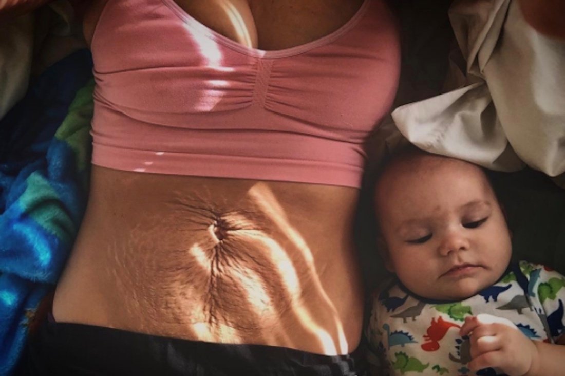 Снимки беременности