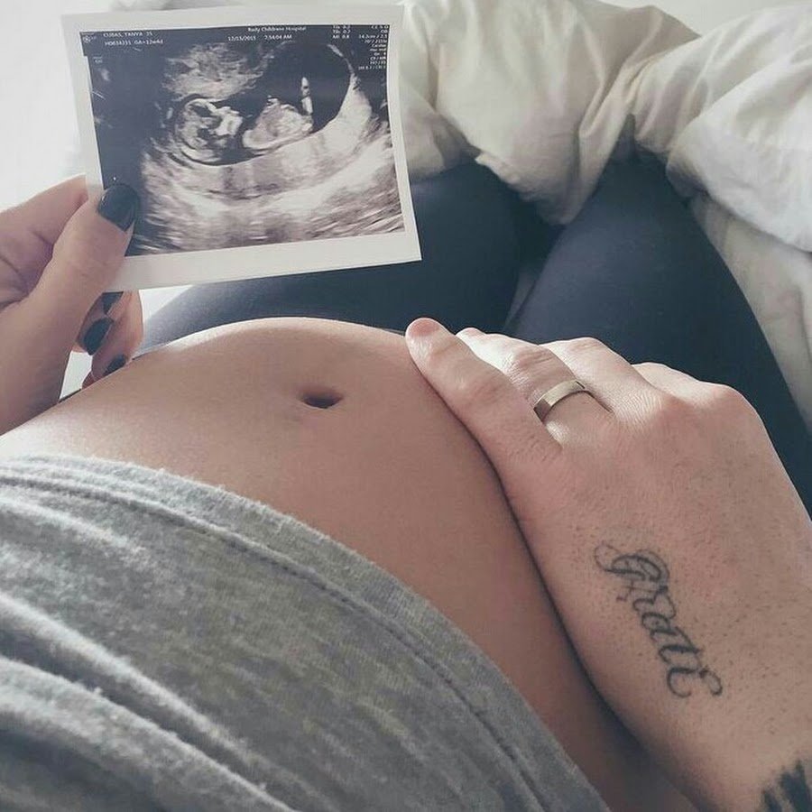 Схематичное изображение беременной женщины